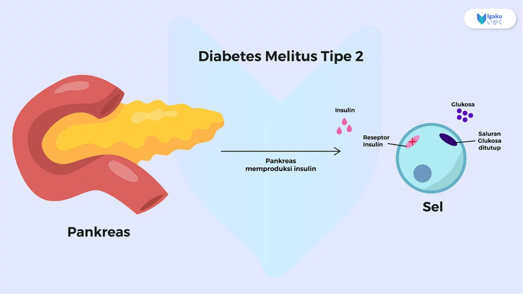 Diabetes Mellitus Tipe 2