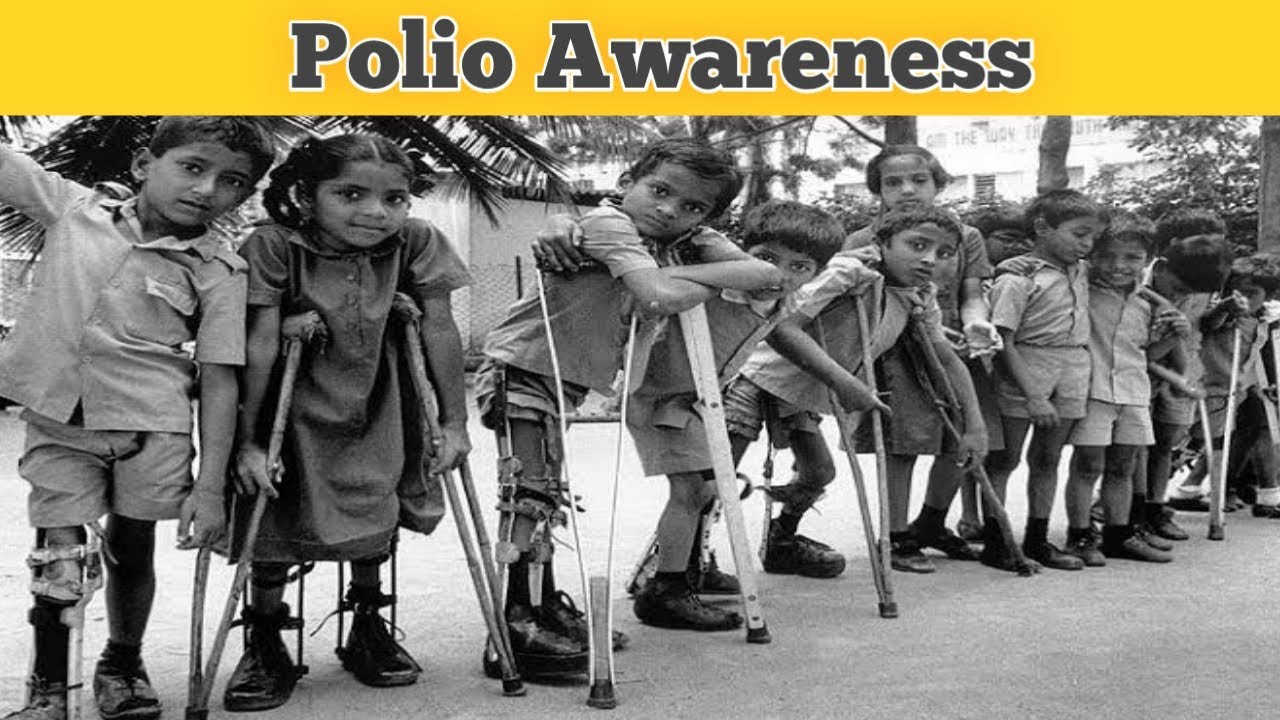 Polio: Ancaman bagi Anak Belum Vaksin