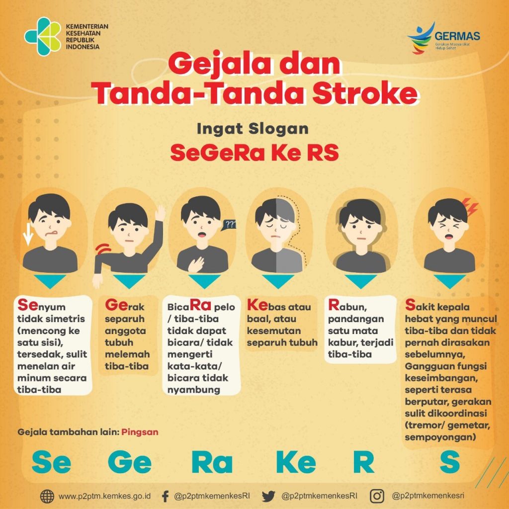 Waspada! Gejala Stroke Bisa Muncul di Mata, Segera Periksa Jika Mengalaminya